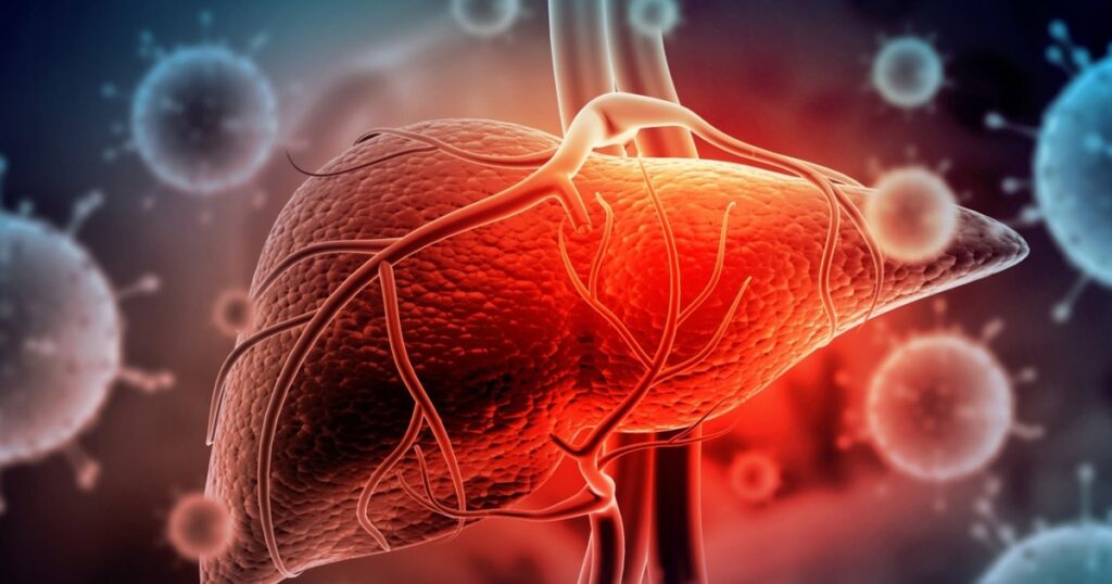 Alertă în Dolj: DSP confirmă 7 focare de hepatită A. Medicii au depistat aproximativ 150 de cazuri