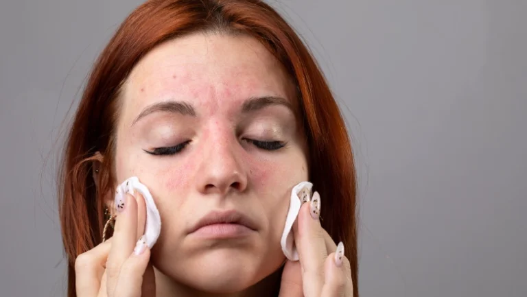 Dermatologii avertizează