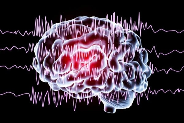 Peste 500 de specialiști participă la Conferința Națională împotriva Epilepsiei