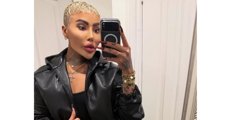 Jordan James Parke, cunoscut pentru obsesia sa de a semăna cu Kim Kardashian, a murit la 34 de ani, în urma unei proceduri cosmetice