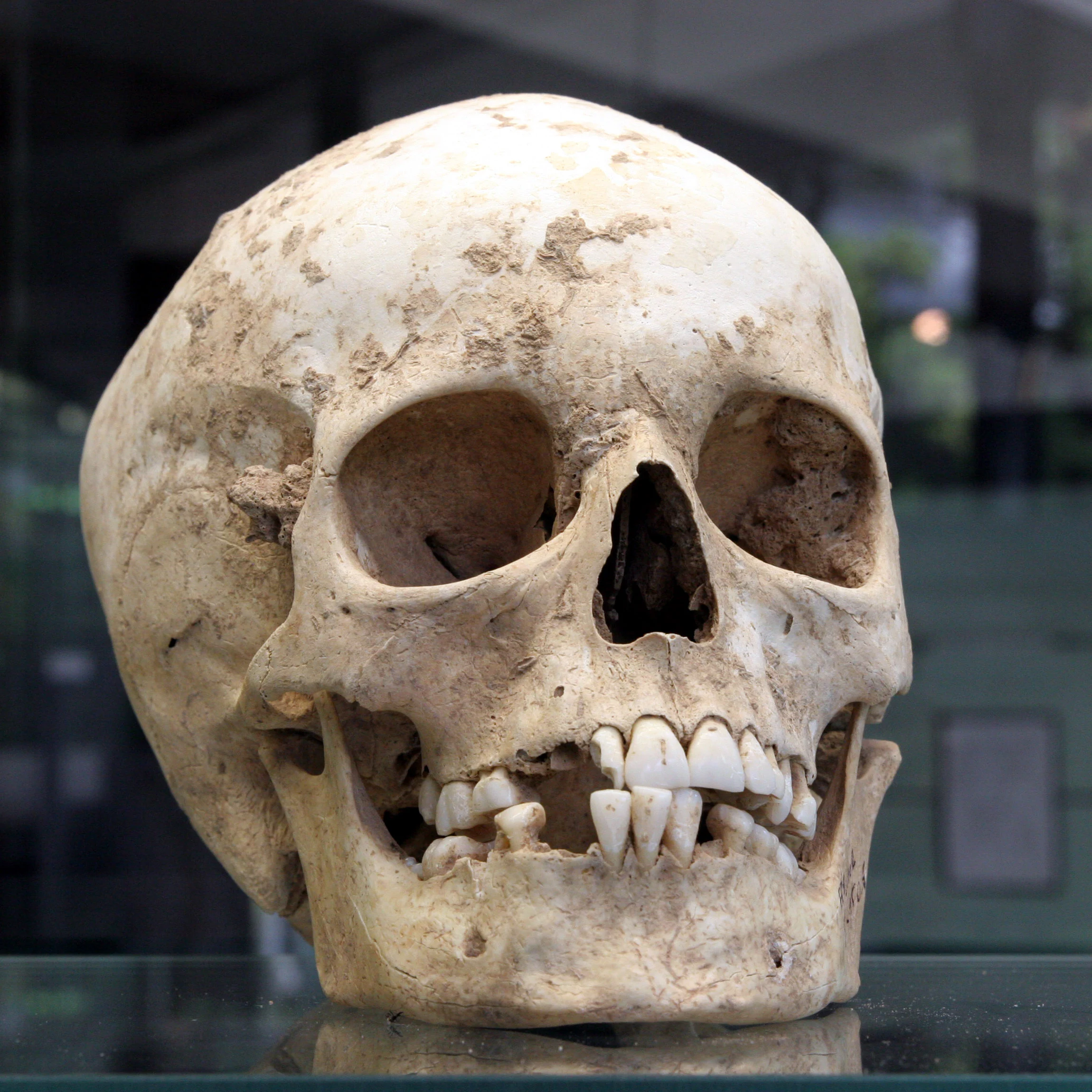 Craniu din neolitic
